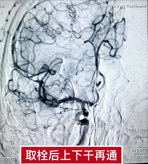 搶抓黃金救治時(shí)間  疏通血管為生命續(xù)航(圖2)