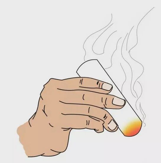 圖片6艾灸 (復制).jpg