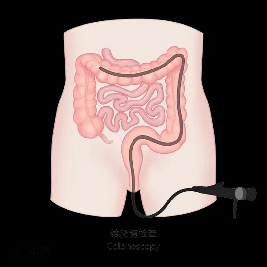 腸鏡5 (Copy).png