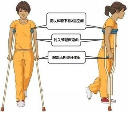 拐杖的“左右為難”——您會(huì)正確使用拐杖嗎？(圖4)