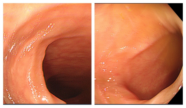 腸2 (Copy).jpg