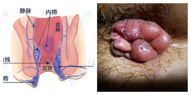 肛腸1 (Copy).jpg